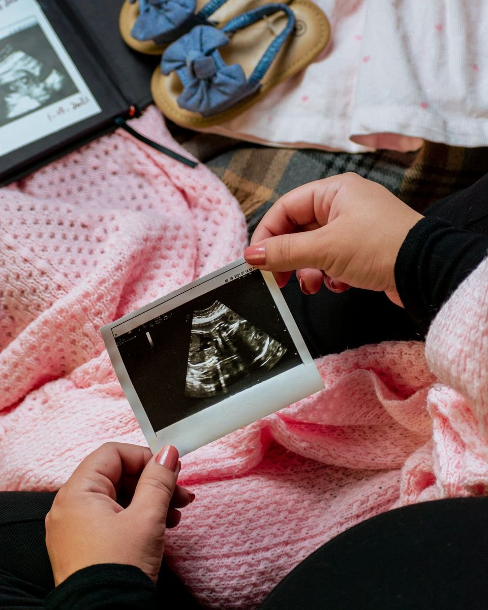 A woman’s hands hold an ultrasound print over a pink knitted blanket, with a scan album and a pair of baby sandals beside her.